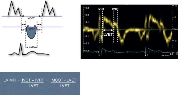 07-echocardiographic-measurement-of-lv-systolic-dysfunction