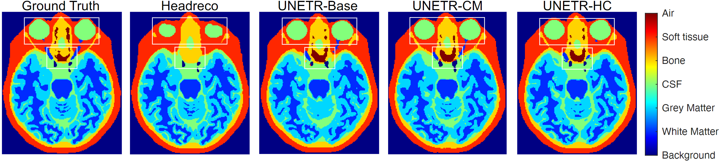 Fig. 4: Sample slice for 6-tissue segmentation