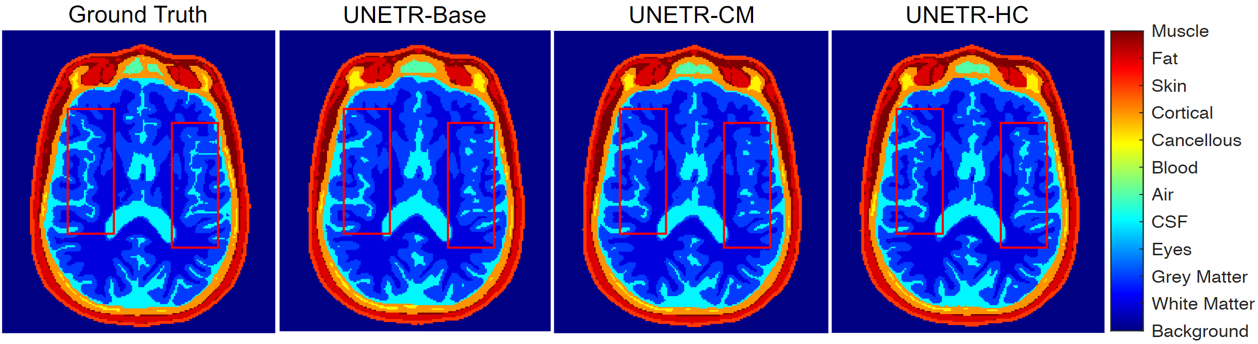 Fig. 3: Sample slice for 11-tissue segmentation