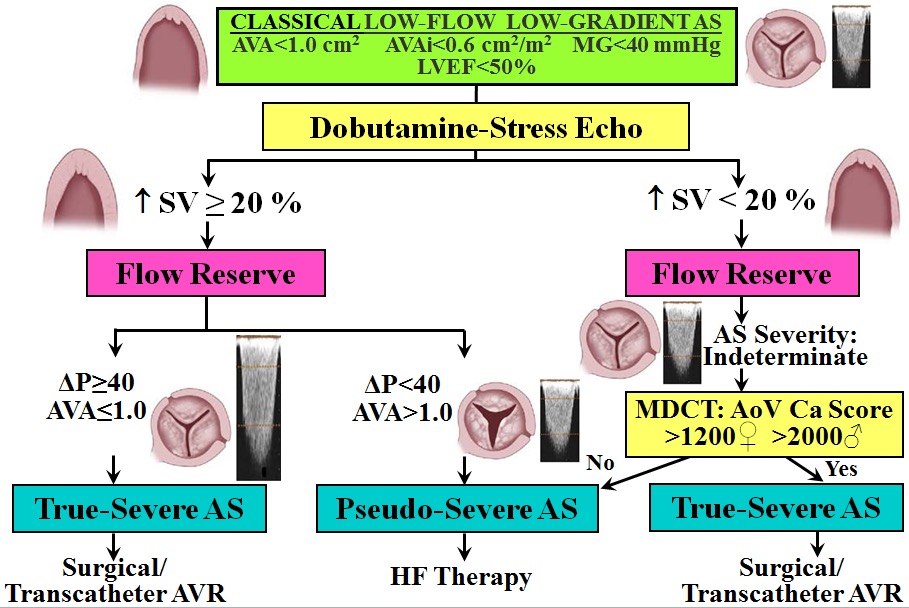 Algorithm for the Assessment of Stenosis Severity and the Management of Classical (low LVEF) LF-LG AS