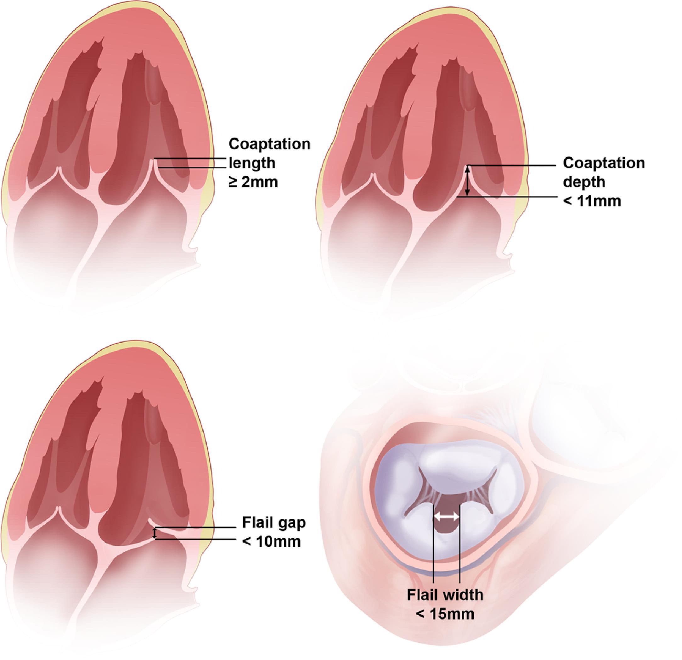 适宜的解剖结构