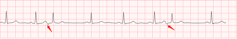 一个典型的房早图例