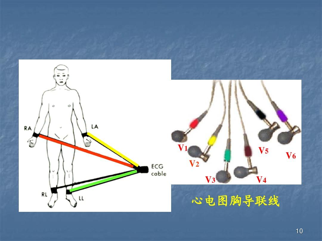常规12导联心电图机的连接