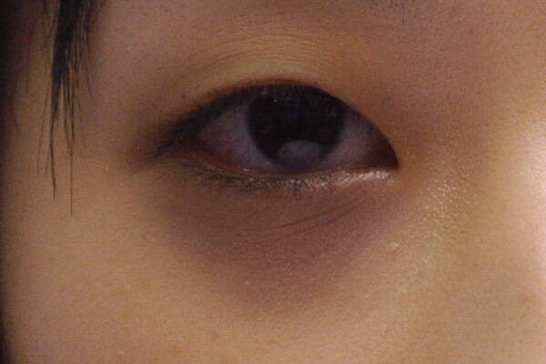 20 Ways to Get Rid of Dark Eye Circles