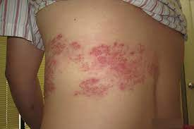 How to prevent AIDS properly?