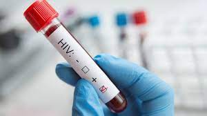 How to effectively treat AIDS