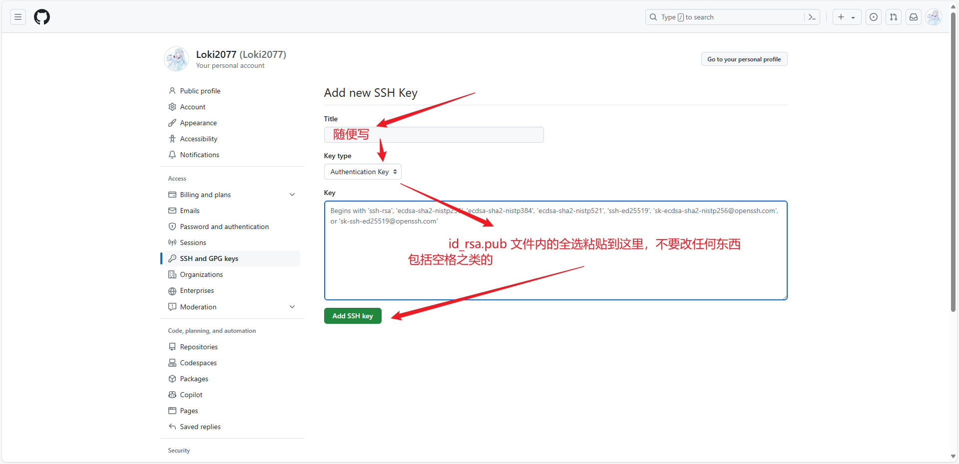 image-20240615191557286