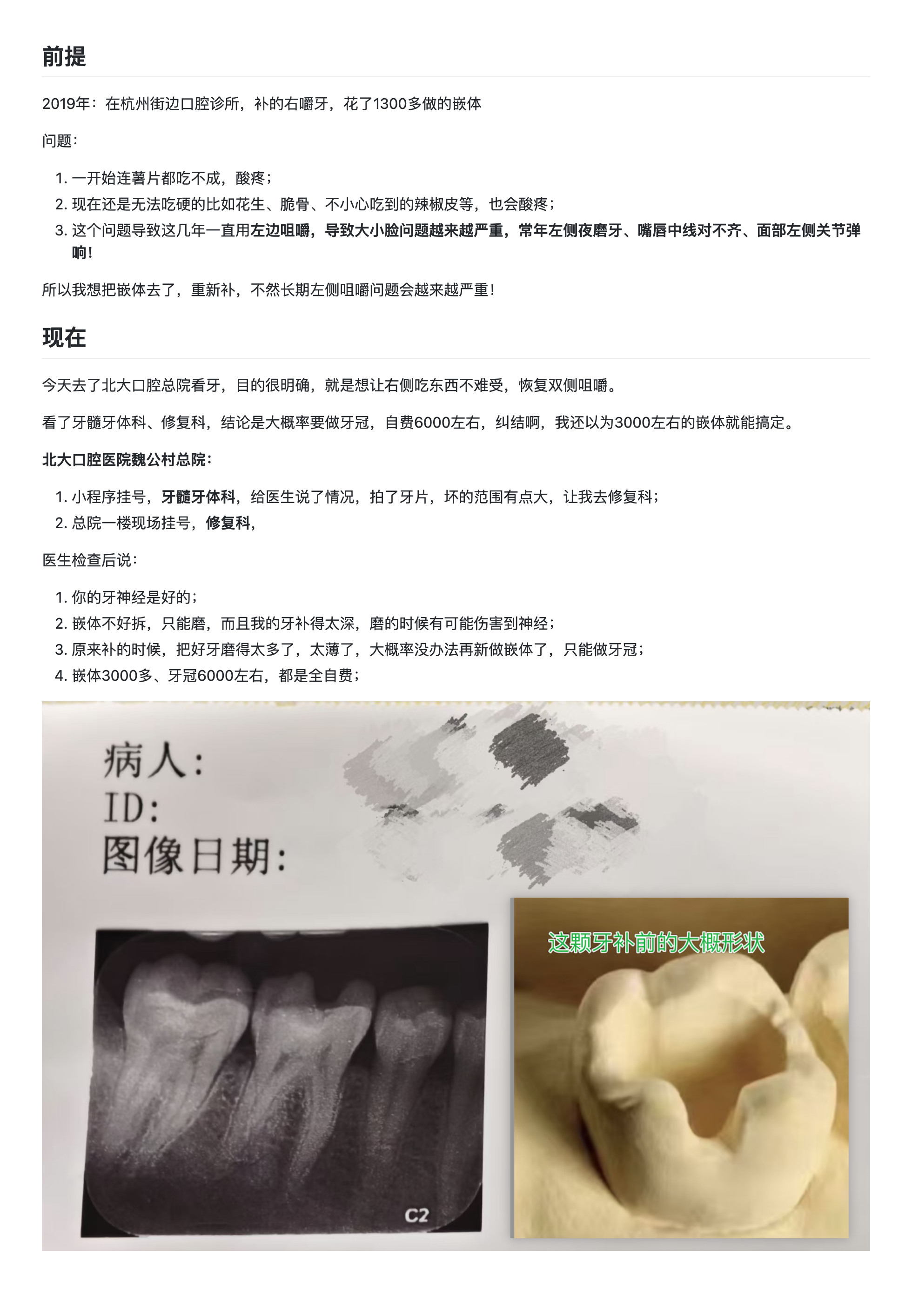 要不要磨掉嵌体做牙冠，自费 6000 块，能保证吃东西正常吗.png